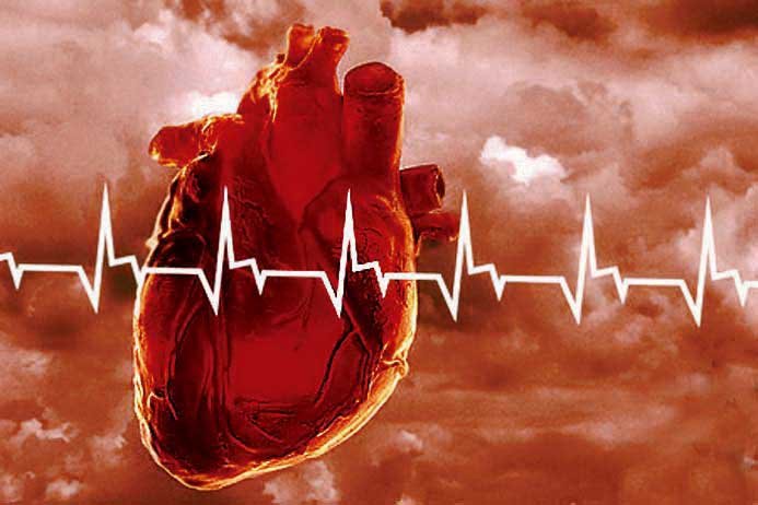 Инновационное лекарство от инфарктов дадут врачам бесплатно