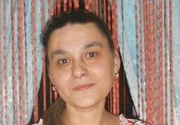 Женщина со шрамами пропала в Новосибирске