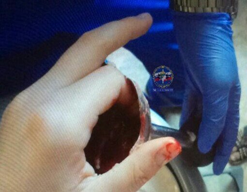 Девушка сунула палец в работающий блендер