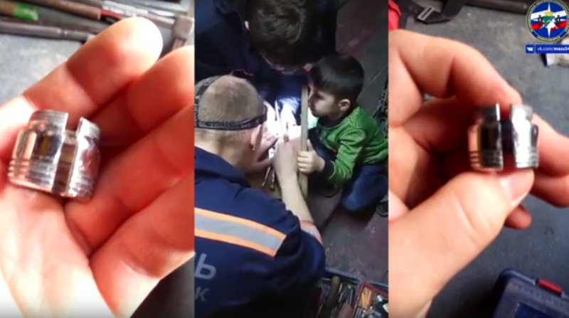 Спасатели 40 минут пилили втулку на пальце ребенка