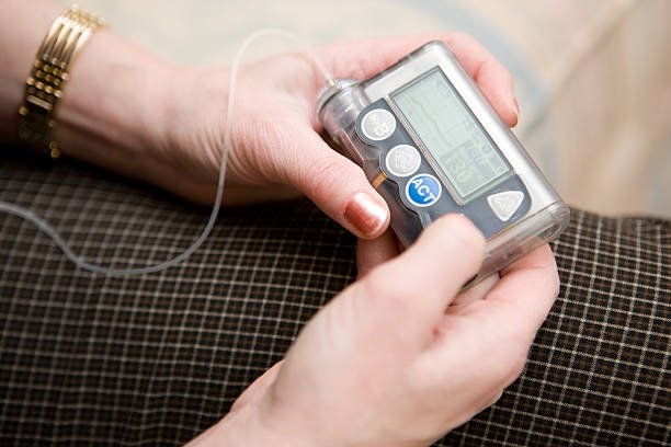 30 тысяч в месяц: диабетики вынуждены отказываться от помп