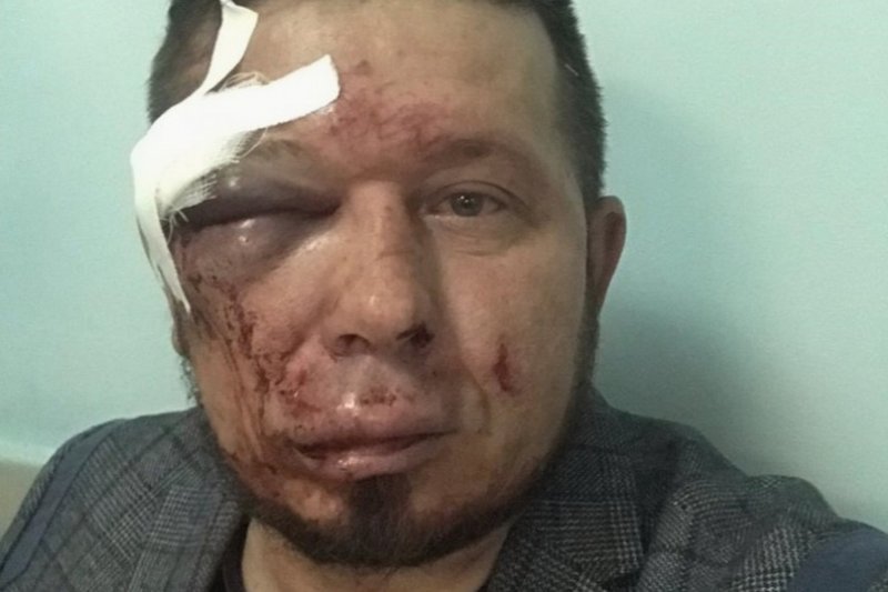 Противника точечной застройки жестоко избили после работы 