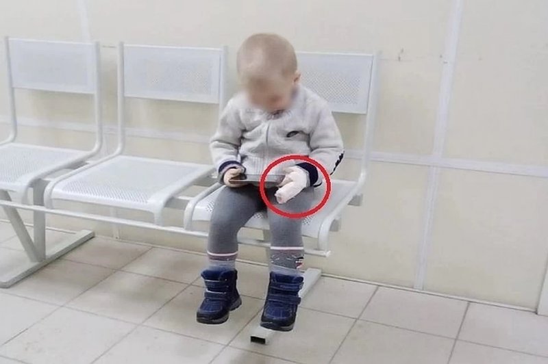 Палец испугавшегося «бабайки» ребенка оценили в 50 тысяч