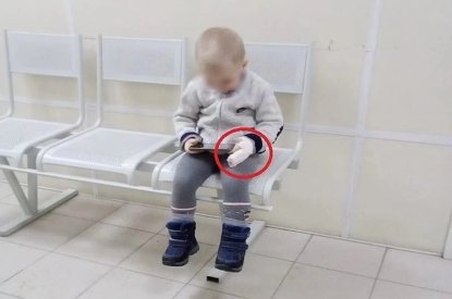 Палец испугавшегося «бабайки» ребенка оценили в 50 тысяч