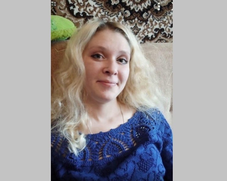 Блондинку со шрамами и без зубов ищут в Новосибирске