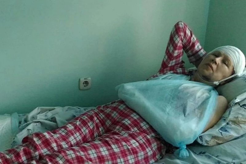 За переломы и опухоль сибирячка пытается отсудить у детского хирурга и его брата 700 тысяч