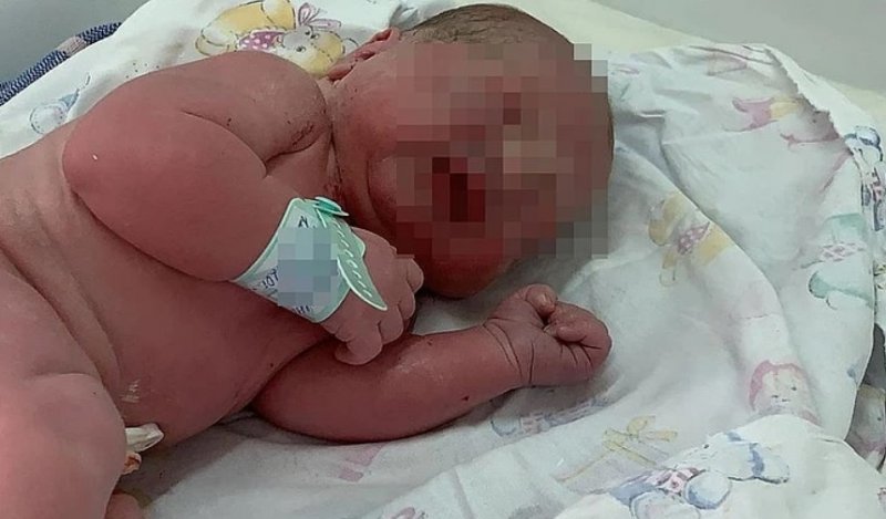 Один день рождения: в Новосибирске две матери родили по двойняшке 