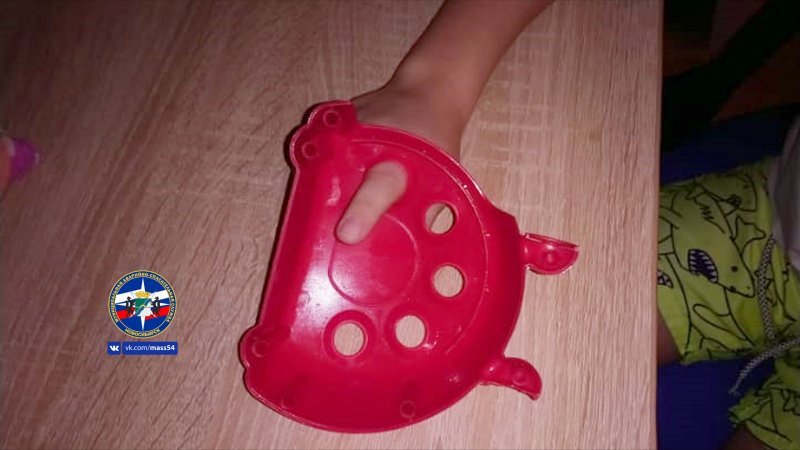 Ребенок чуть не лишился пальца из-за пластмассовой игрушки