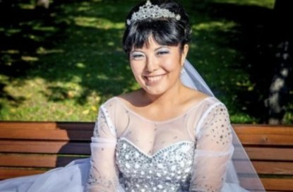 «Я не могу раздеться даже при муже»: о том, как роковая операция испортила жизнь сибирячке 