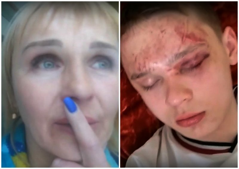 Не только избили, но еще и ограбили: в драке на Колхидской у подростка отобрали телефон и наушники
