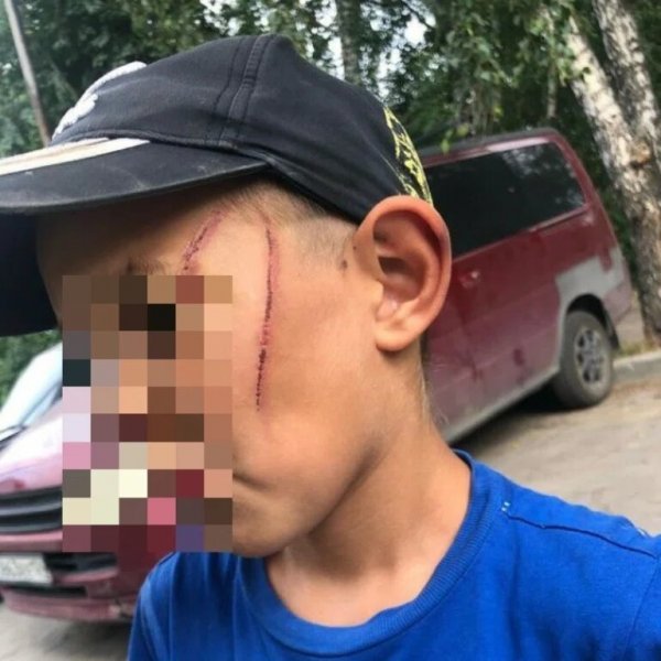 Глава СКР Бастрыкин взял на контроль дело об избиении ребенка проводом от чайника в Новосибирске