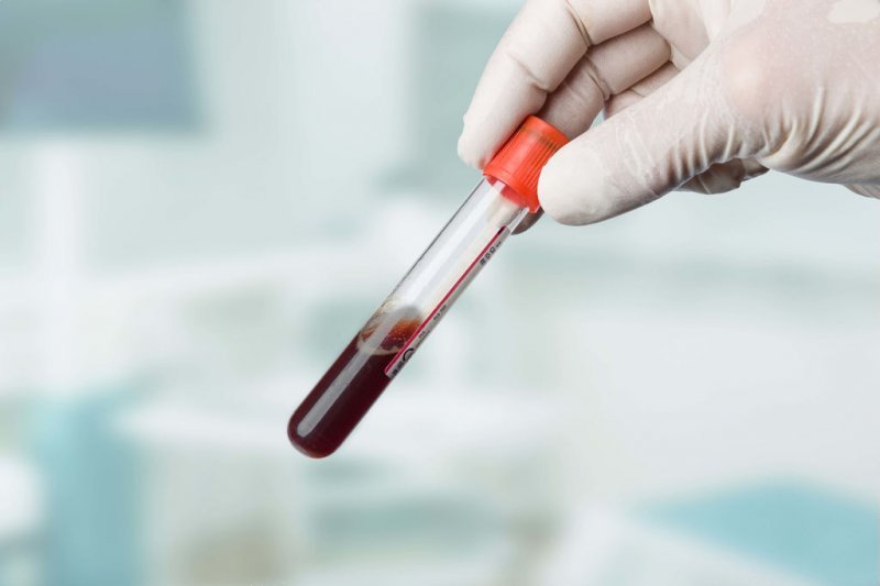 Что можно узнать по группе крови?