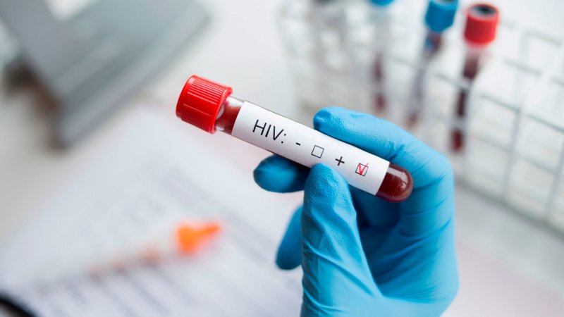 Число новых выявленных случаев ВИЧ-инфекции третий год снижается в Новосибирской области