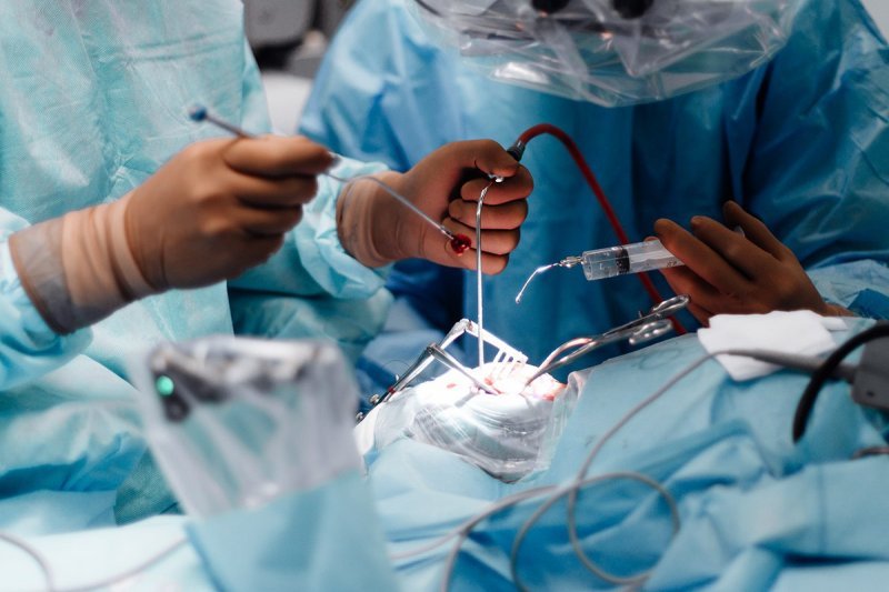 Хирурги удалили гигантскую опухоль из мозга 6-летней пациентки