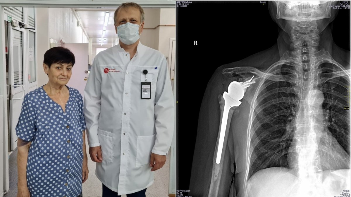 Первый индивидуальный 3D-имплант создали для новосибирской пациентки 