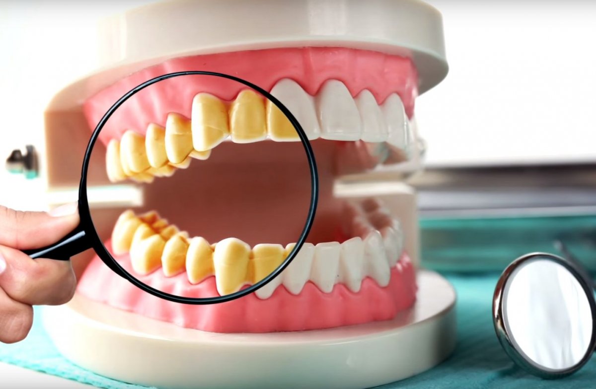 Чистка зубов в нижнем