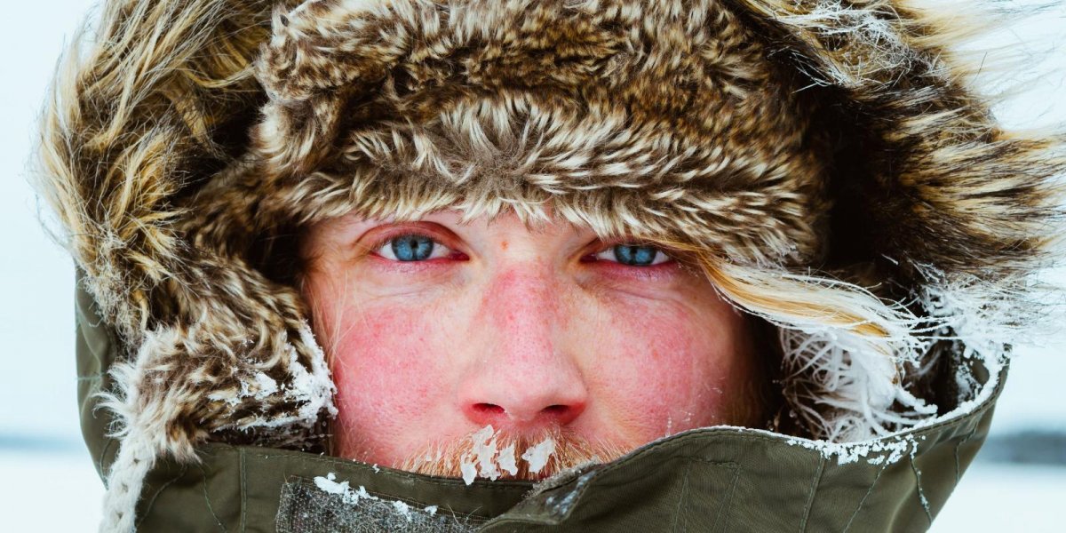 Как выжить зимой в Сибири с холодовой аллергией: советы дерматолога