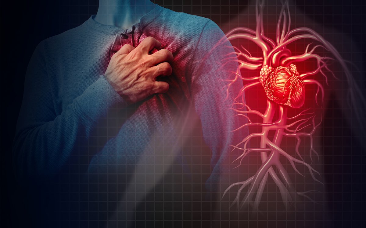 6 способов умереть от инфаркта: ошибки пациентов и врачей