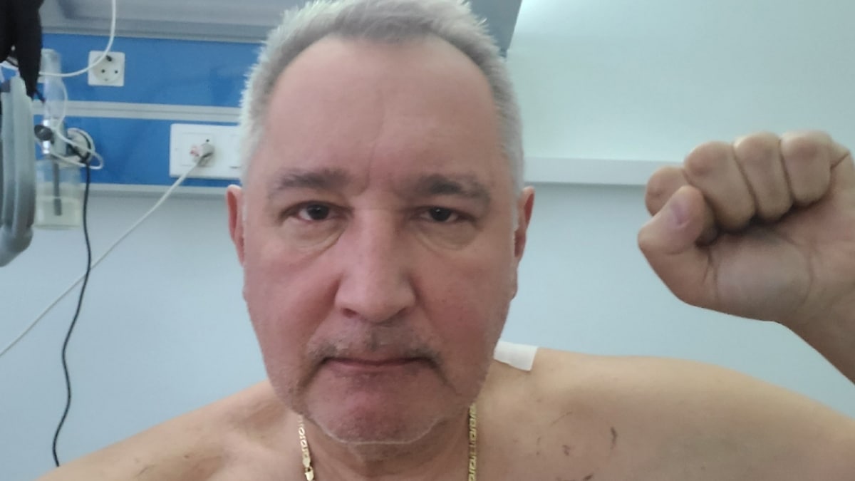 Рогозин вышел на связь: операция прошла успешно, чувствую себя хорошо