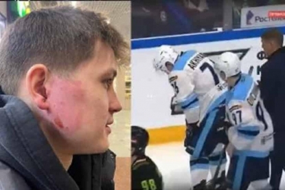 Защитил ворота ухом: хоккеист «Сибири» Тимур Ахияров получил травму во время матча (ВИДЕО)