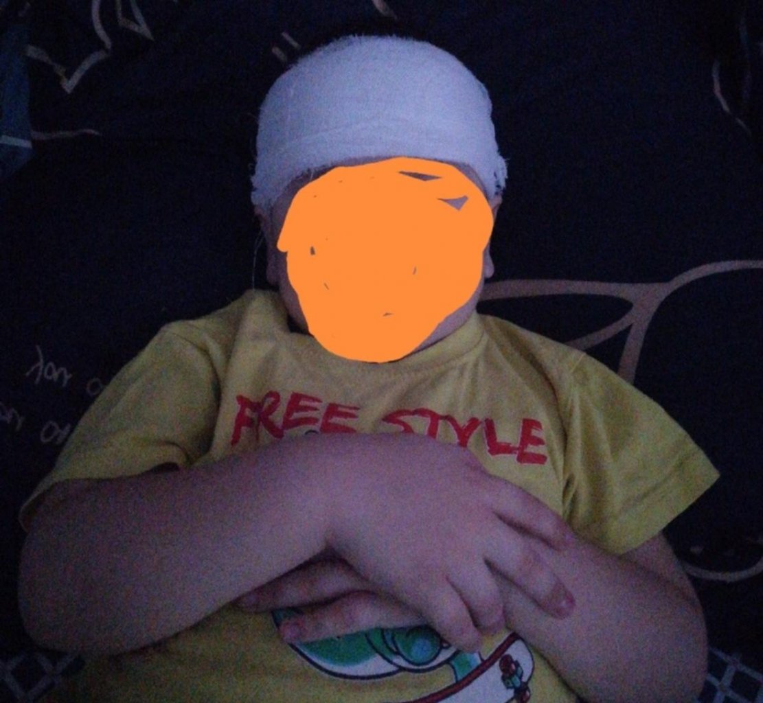 Бастрыкин поручил проверить отказы врачей лечить 4-летнего ребенка с разбитой головой