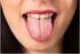 Беспокоит металлический привкус во рту – с чем может быть связан этот симптом?