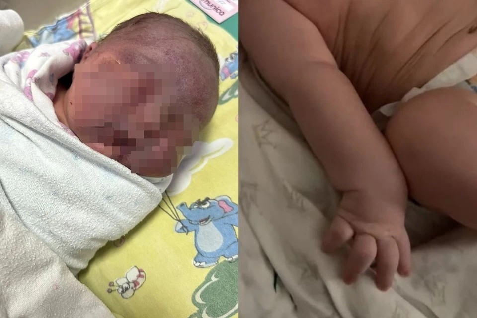 Младенцу парализовало руку в роддоме – заведено уголовное дело