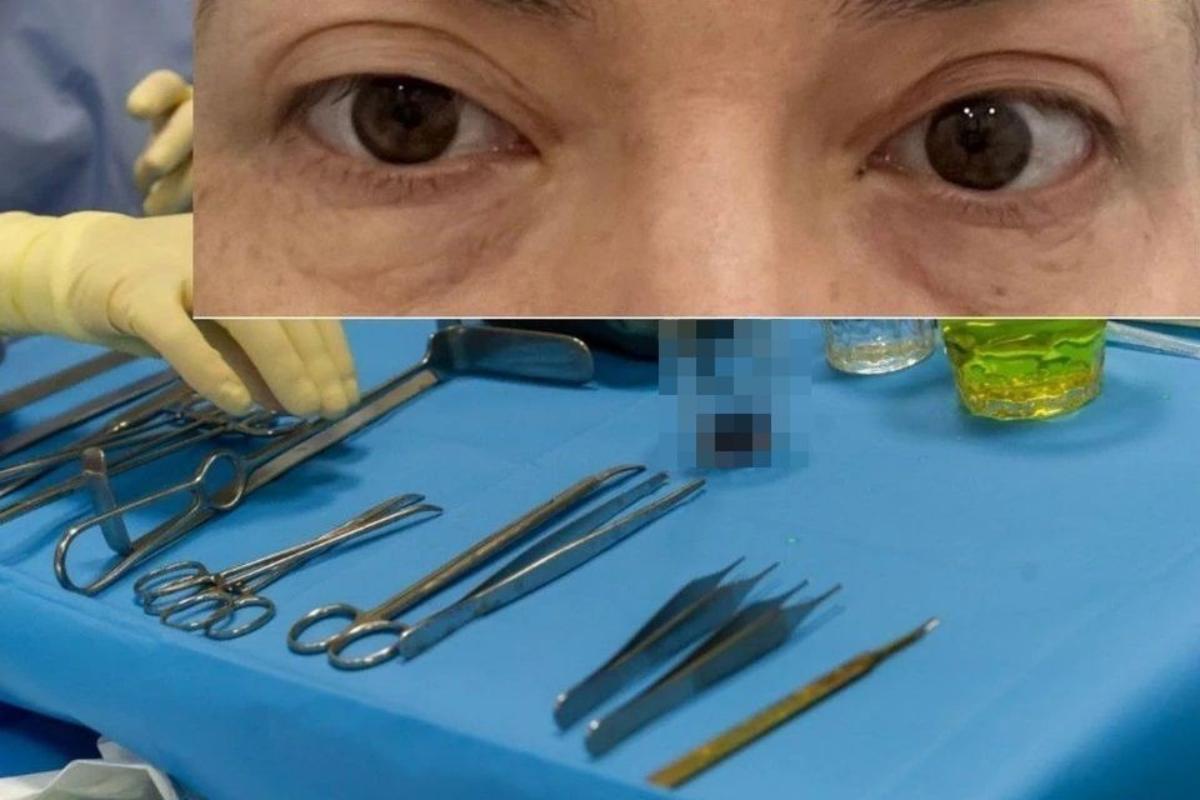 «Перед операцией хирург молился»: клиника выплатила пациентке 380 тысяч рублей за изрезанные веки