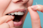 Распространенный миф о зубной нити, из-за которого вы избегаете использования этого крайне полезного приспособления