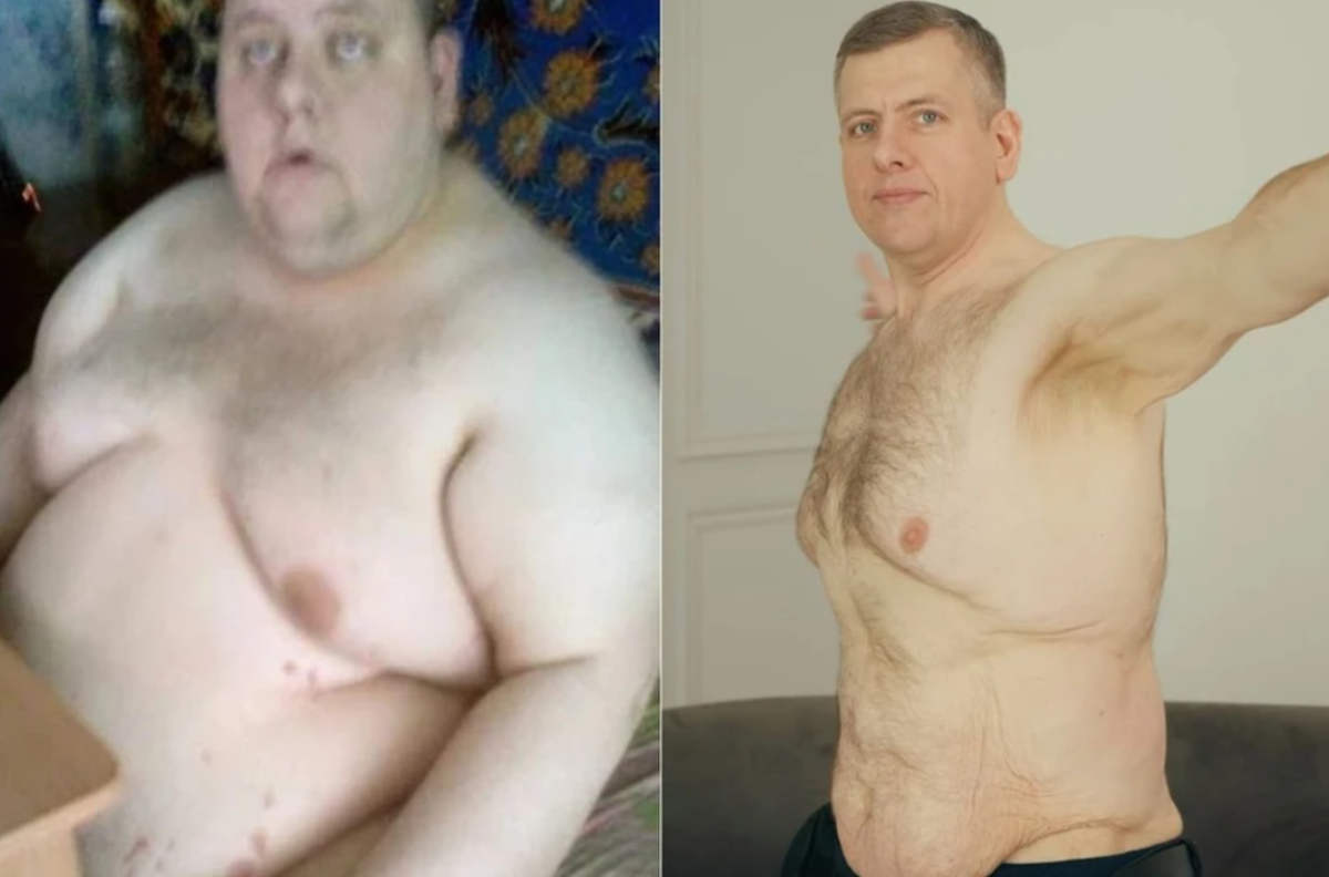 Мужчина смог похудеть на 90 килограммов – от чего он отказался